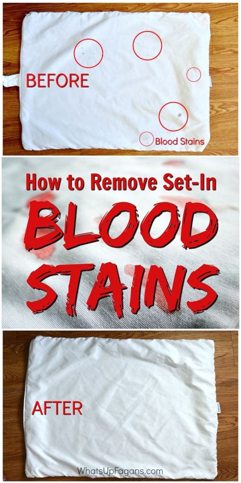 remove dried set  blood stains  clothes cleaning hacks