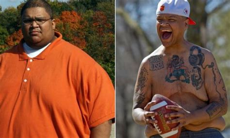 Man Who Lost 750lbs After Gastric Bypass Wants To Inspire