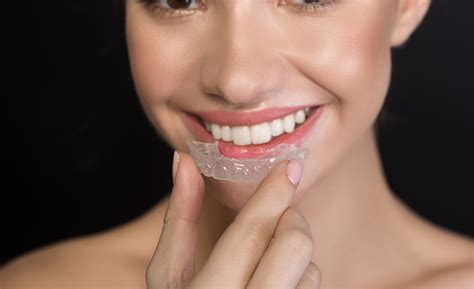straighter teeth  clear aligners healthy smile dental