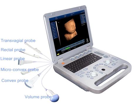 ultrasound machine dd laptopportable ultrasound machine price buy