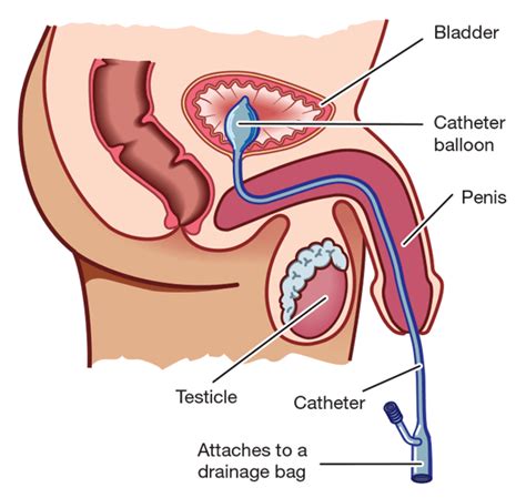 penis prostate picture