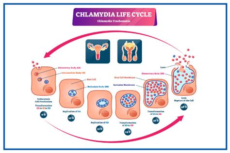 Chlamydia Infection Dos And Don’ts Causes And Risks Treatment
