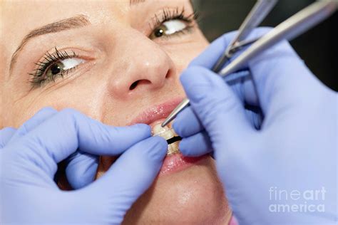 Orthodontist Tightening Braces Photograph By Microgen Images Science