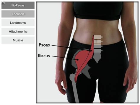 ‎trigger point therapy for the iliopsoas on apple books