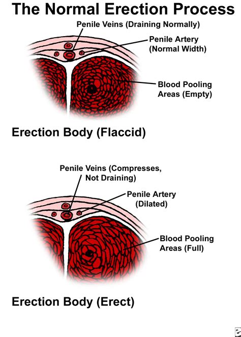 erectile dysfunction causes and treatment options