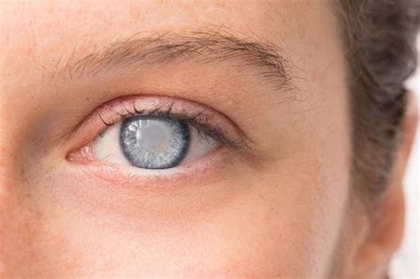 common eye problems   treatment