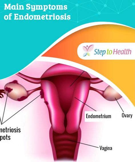 Pin On Endometriosis Information