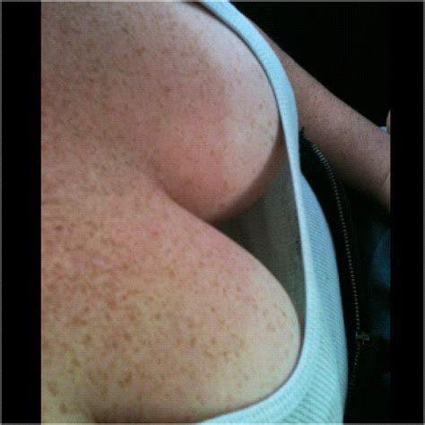 freckled cleavage