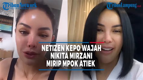 Netizen Kepo Wajah Nikita Mirzani Yang Habis Oplas Mirip Mpok Atiek