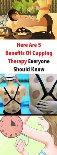 9 reasons you should try cupping therapy cupping therapy