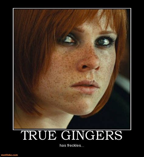 true gingers has freckles yes i love me some freckles