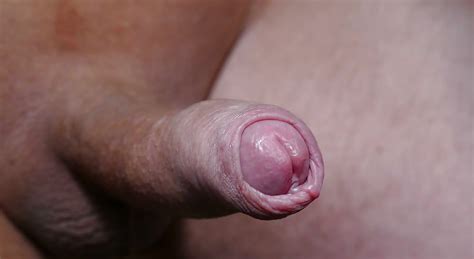 My Uncut Cock Closeup Foreskin And Head 30 Pics Xhamster
