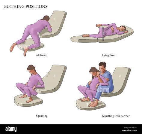 illustration    birthing positions  fours lying