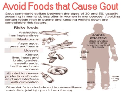 what foods to avoid for gout attack 2018 ~ arthritis