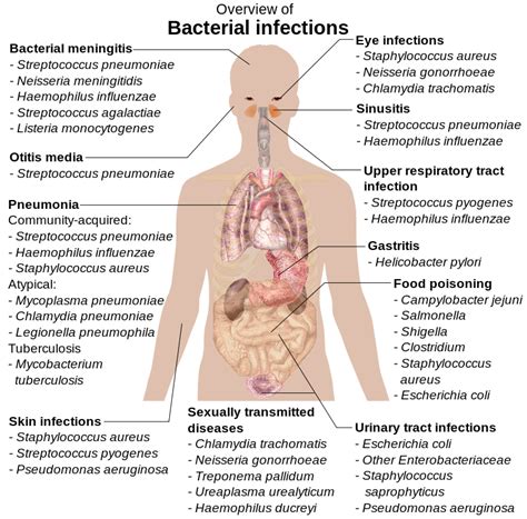 Overview Of Bacterial Infections Medical Laboratories