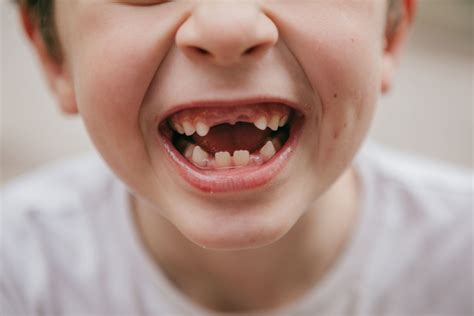 kids start losing teeth expert guide  baby teeth