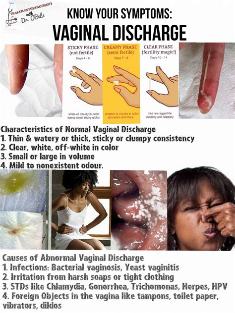 White Vaginal Discharge No Odor How To Decode Your Vaginal Discharge