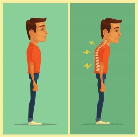 bad posture effects  fixes  bodywise clinic