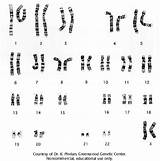 Karyotype Karyotyping Chromosome Cariotipo Dnalc Genetic Femminile sketch template