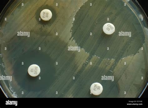 petri dish  antibiotic sensitivity discs showing inhibition zones stock photo  alamy