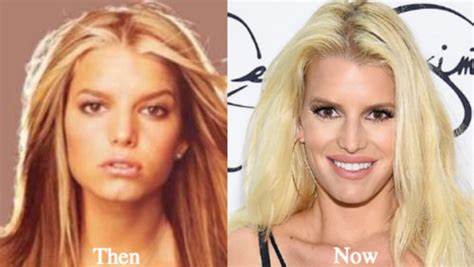 jessica simpson plastic surgery before and after photos latest