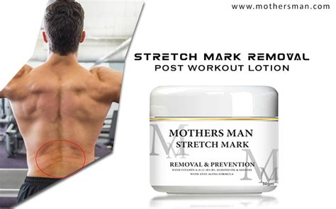 Best Stretch Marks Removal Cream – Mothers Man Mothers Man