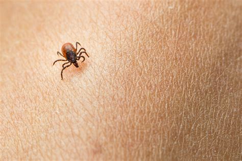 Understanding Your Diagnosis 8 Things You Need To Know About Lyme Disease