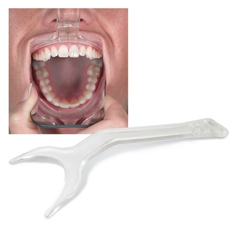 retract eez photo lip retractor ortho technology