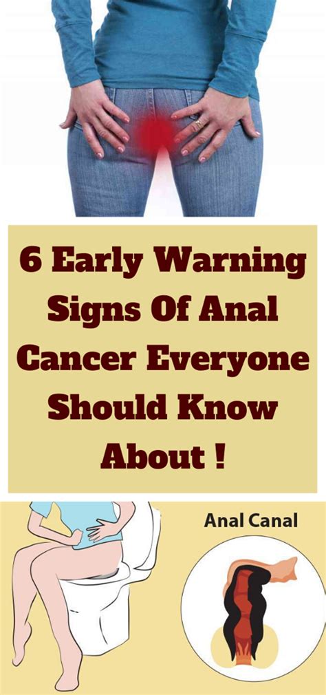 6 Early Warning Signs Of Anal Cancer Everyone Is Too Embarrassed To