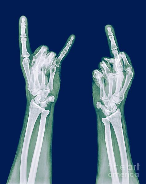 obscene gestures x ray photograph by guy viner