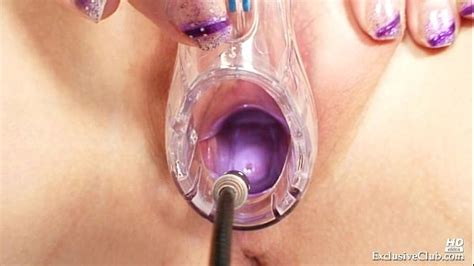zaneta has her pussy gyno speculum examined by old doctor xvideos