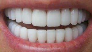 gebit tanden menselijk lichaam