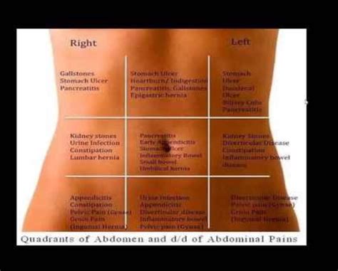 “abdominal Pain” Abdominal Pain Is Pain That You Feel