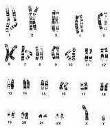 Karyotype Biology Normal Activities Teaching Chromosome Syndrome Male Human Down School High Chromosomal Disorders Classroom Tile Trisomy Female Microbiology Neuroscience sketch template