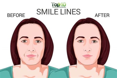 prevent  minimize smile lines top  home remedies