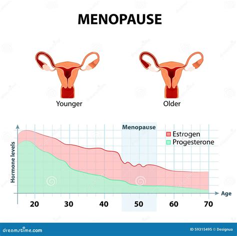 Menopause Or Climacteric Stock Vector Image 59315495