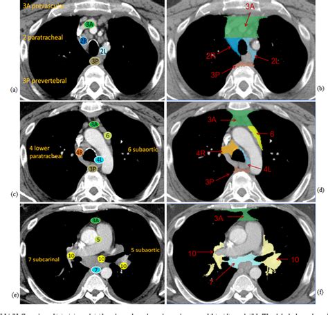 Chest Lymph Node Anatomy