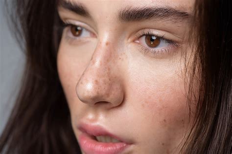 11 things that freckled people must endure curatedition