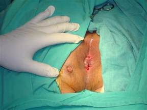 Pictures of persistant anal fissure