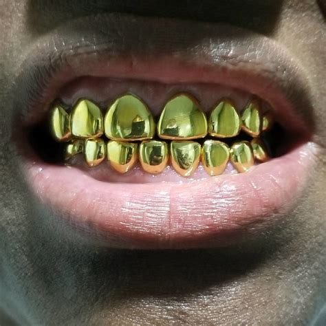 gold permanent crowns