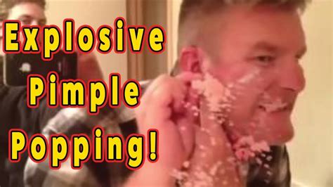 disgusting pimple  cyst popping  explosive youtube