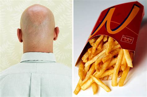 Hair Loss Cure Mcdonald’s French Fries Contains Something