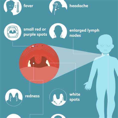 strep throat signs symptoms  complications