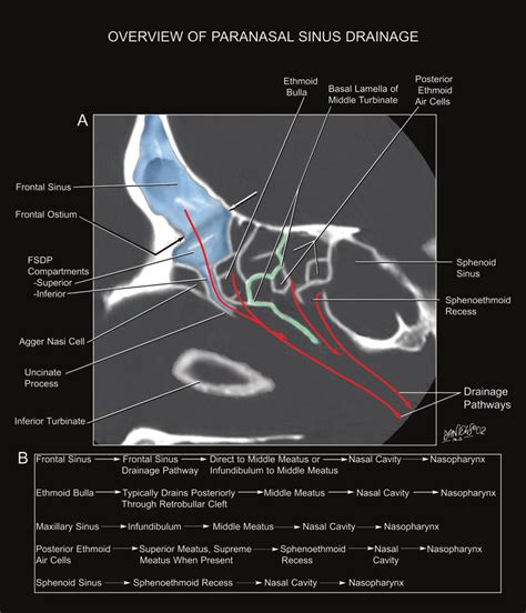 overview   drainage pathways   paranasal sinuses