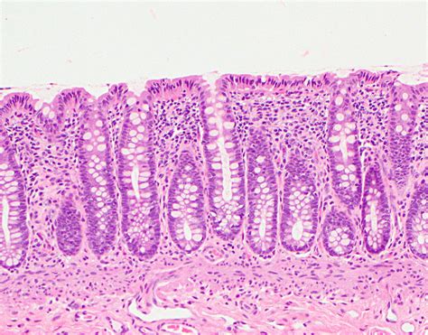 colon histology  labeled