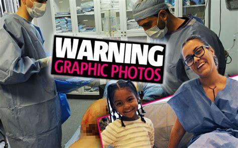 Under The Knife ‘teen Mom’ Star Briana Dejesus Gets An