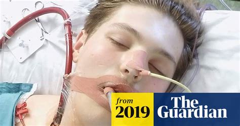 Uk Teenager Needed Life Support Over Vaping Linked Disease Vaping
