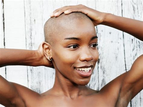 5 things i learned about alopecia on my hair growth journey essence