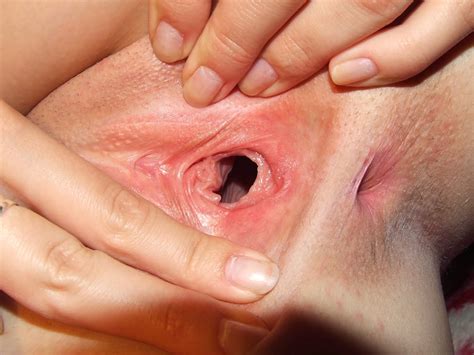 broken hymen close up