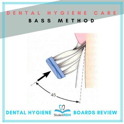 tooth brushing technique involves  application   bristles   sulcular area